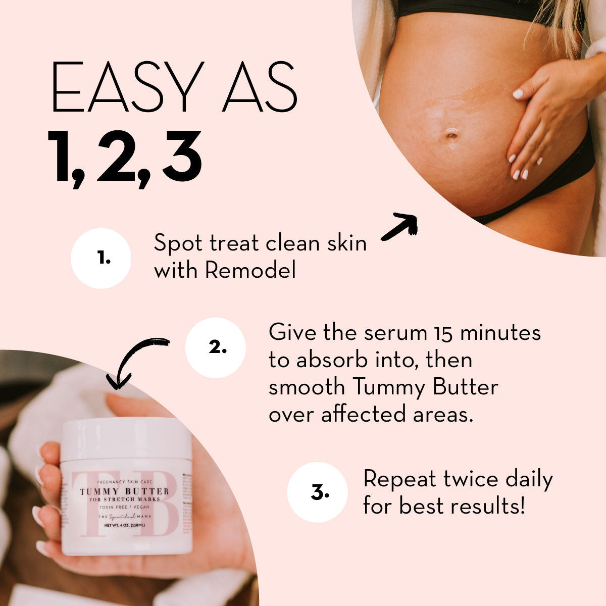 ReModel Serum: Say Goodbye to Stretch Marks