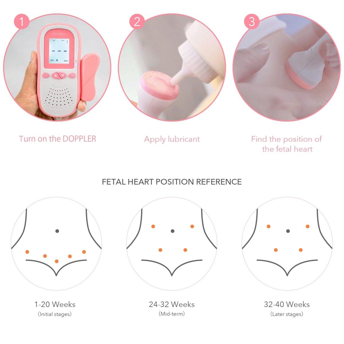 SpringBud FD-500B Fetal Doppler FDA Cleared